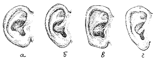 Рис. 49. Форма (контур) ушной раковины: а - круглая; б - овальная; в - прямоугольная; г - треугольная